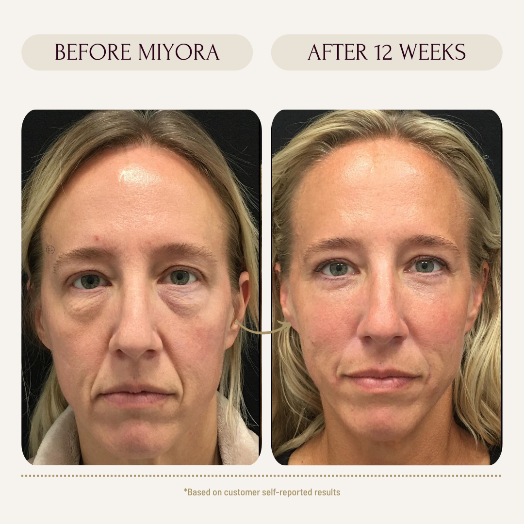 Firm & Glow PROTOCOL